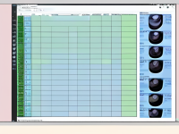 孕期待产B超注意指南